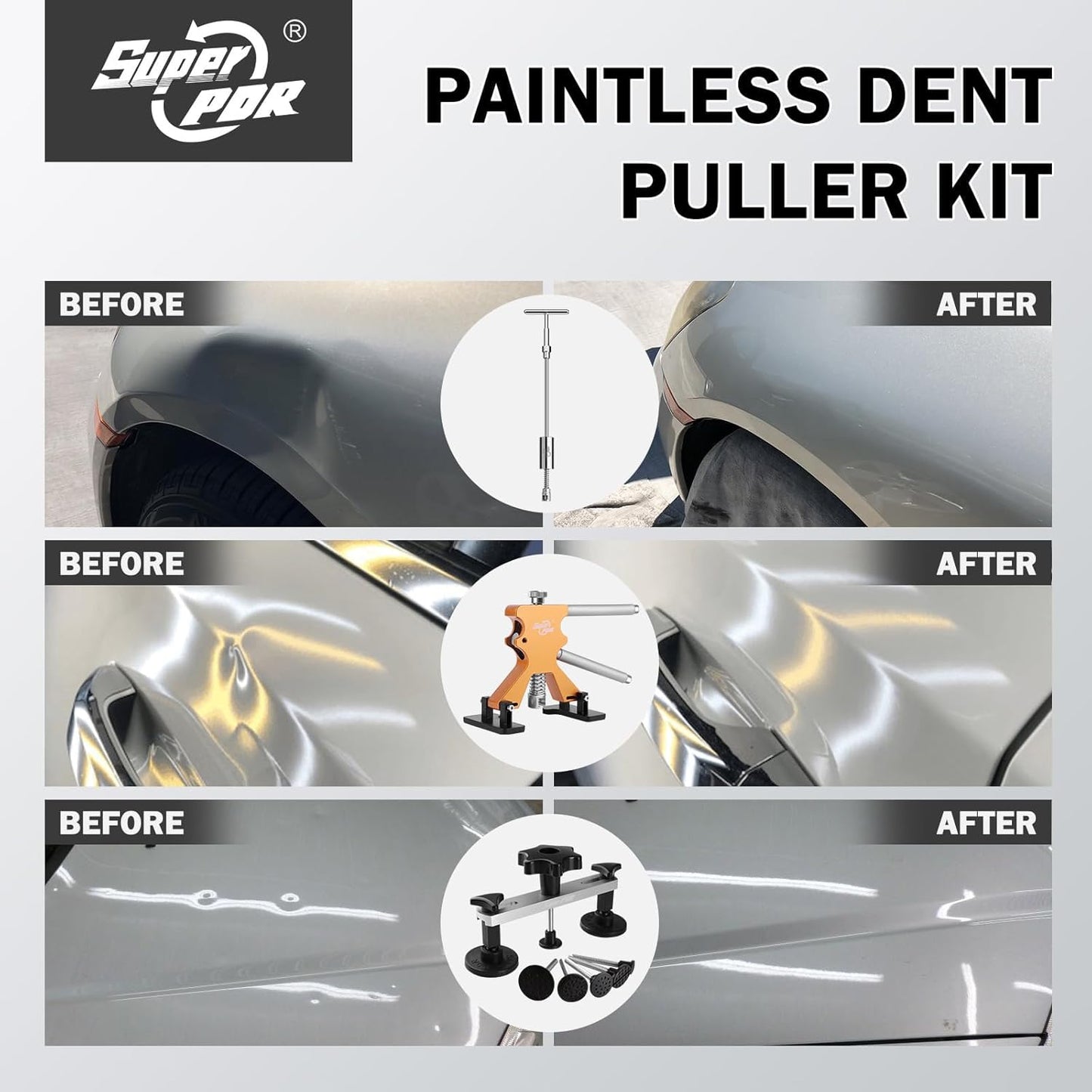 Super PDR Car Dent Puller Kit, 148 PCS Paintless Dent Repair Kit with LED Line Board, Slide Hammer, T-Bar, Dent Lifter & Bridge Puller, PDR Tools for Auto Body Repair, Dent Remover Tool for Car SUV