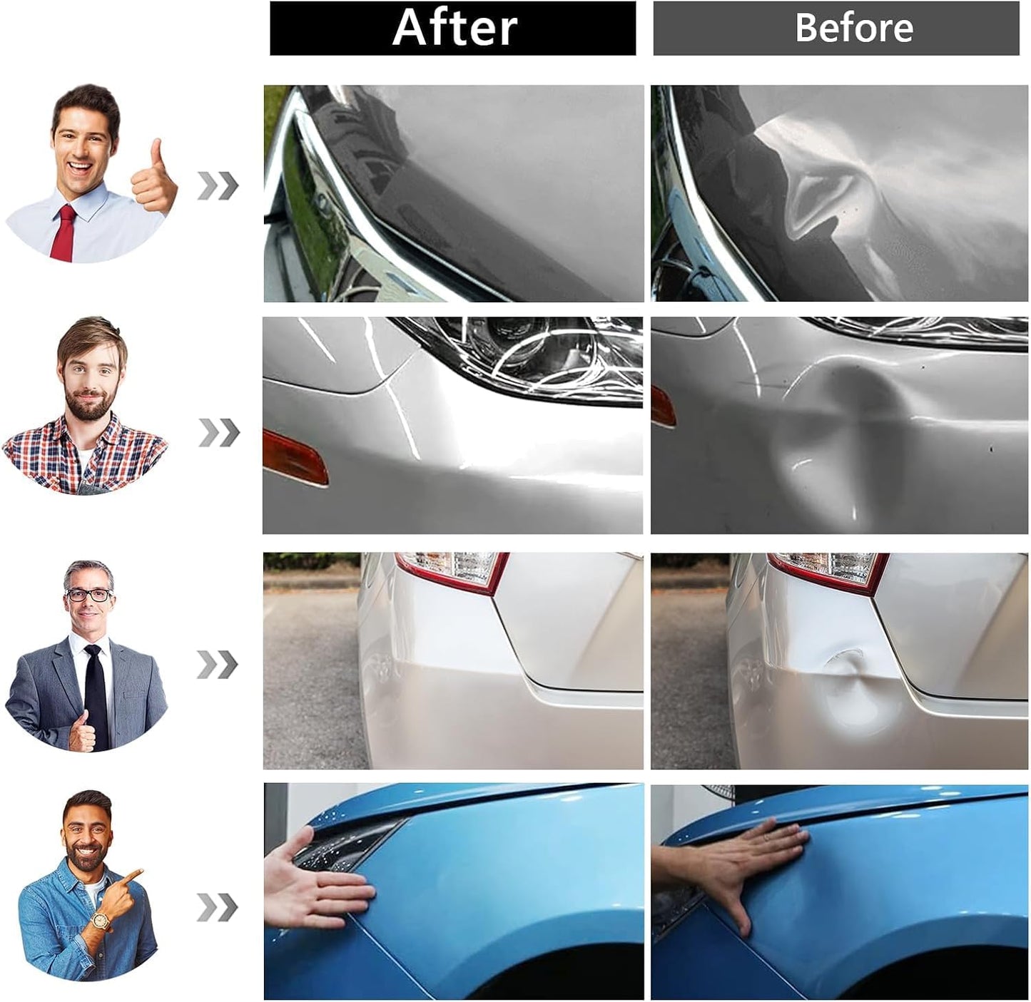 Car Dent Puller Kit, Painless Dent Removal Kit with Adjustable Dent Lifter, Hot Glue Gun, Dent Puller for Small Dents & Big Dents,Reusable Car Body Dent Repair Tool (Small & Big dent)